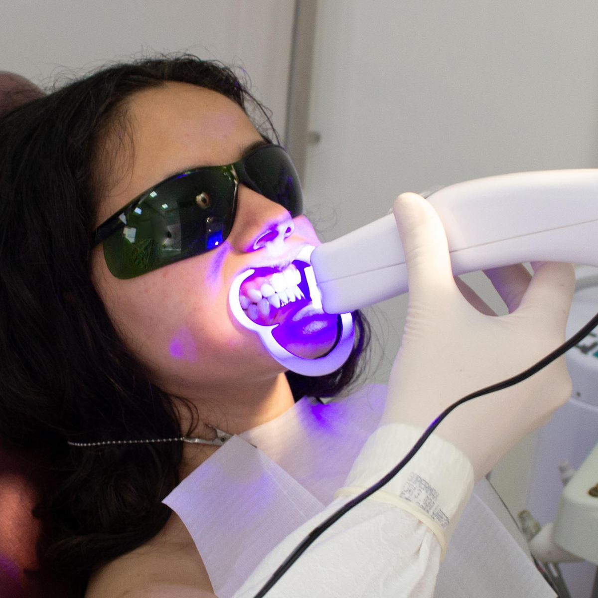 teeth whitening teeth-whitening