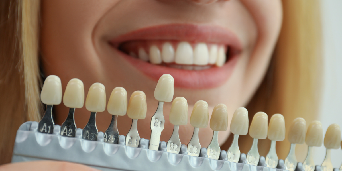 Woman smiling while a tooth shade guide is held up to compare cosmetic dentistry options